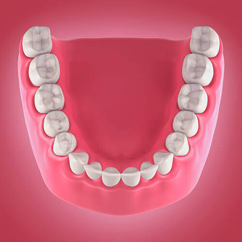 Denture illustration